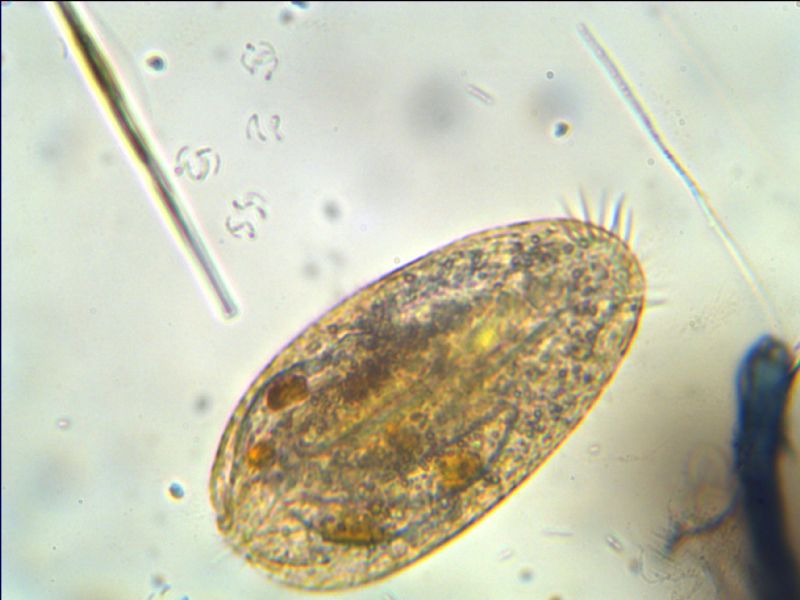 ciliato con inclusioni